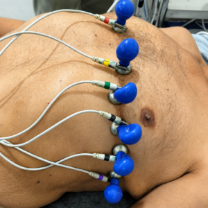 ECG Machine