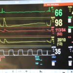 Patient Monitor With Seven Parameters