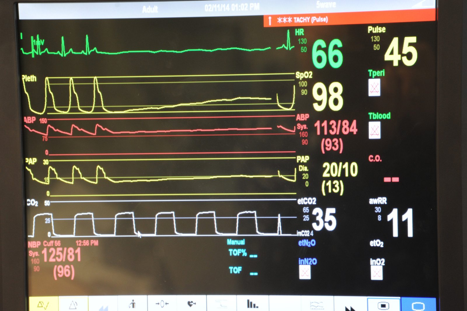 Patient Monitor With Seven Parameters